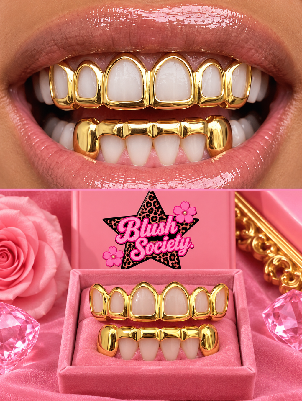 Gold Open-Face Grillz Set – Gold Grillz Set – Choose 1 Style or Bundle All 3