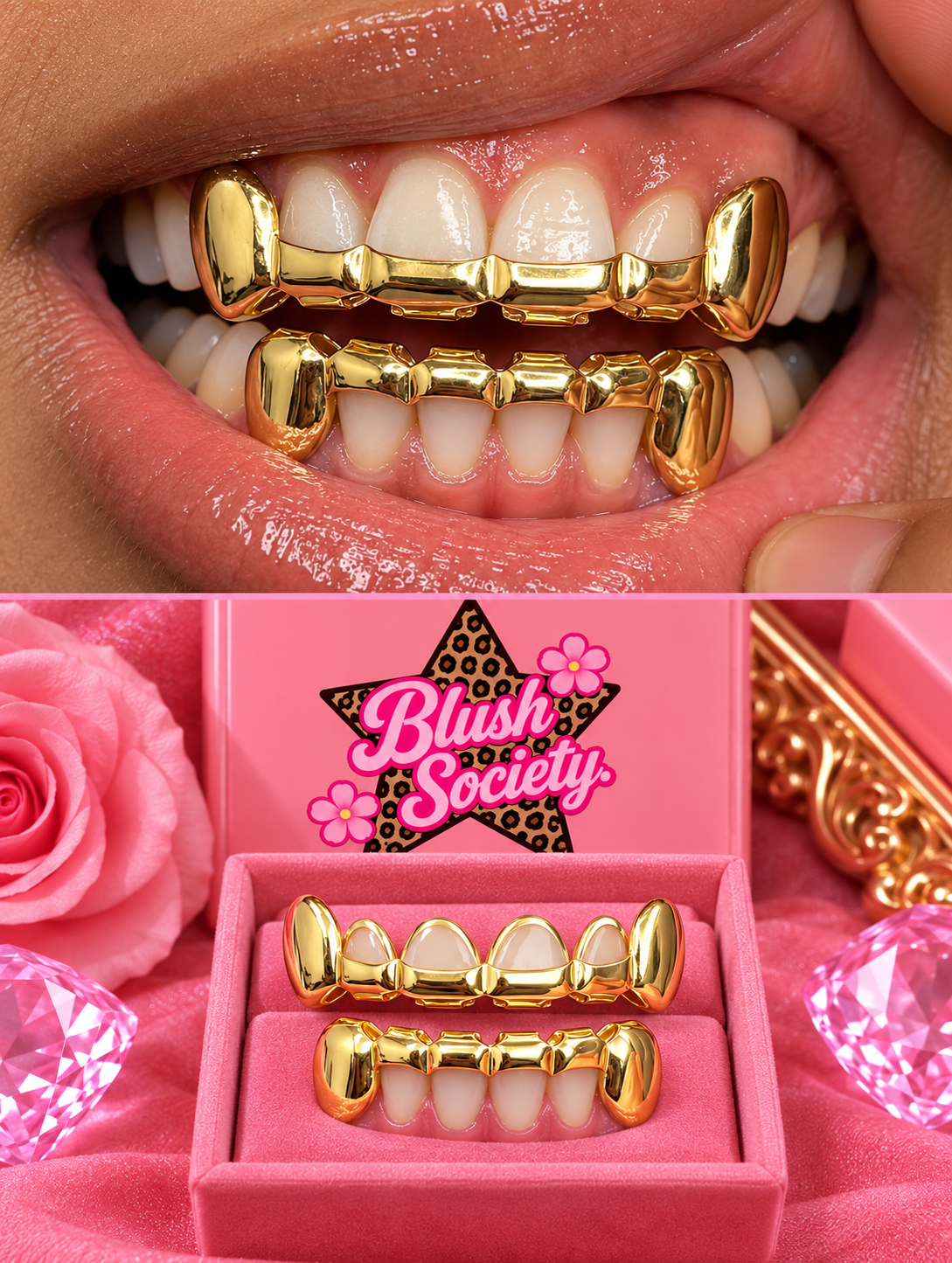 Gold Open-Face Grillz Set – Gold Grillz Set – Choose 1 Style or Bundle All 3
